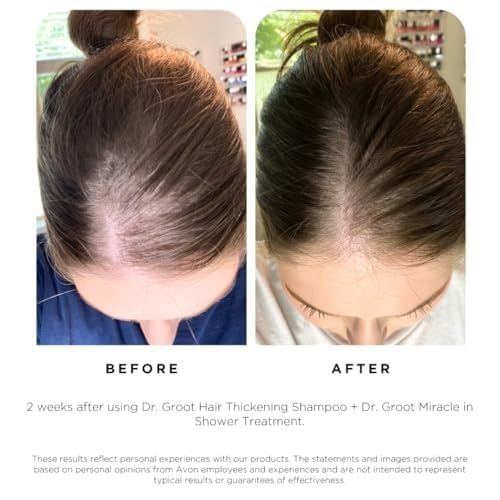 Scalp Revitalizing Thickening Shampoo - 23.66 fl oz 2-Pack