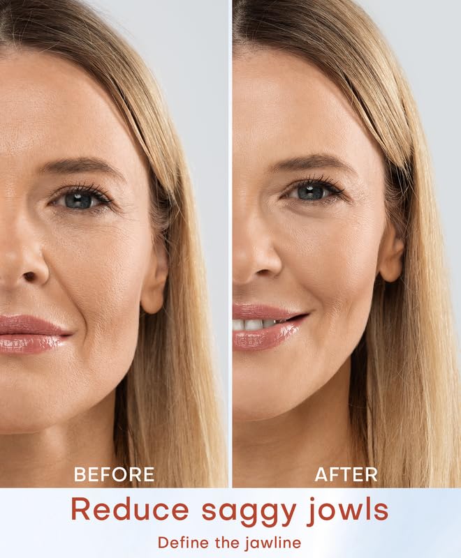 Open-Box New MLAY Professional RF Skin Tightening Machine - 2 Probes Anti-Aging